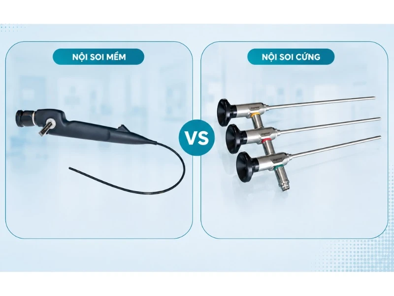 Nội soi tai mũi họng bằng ống mềm và ống cứng