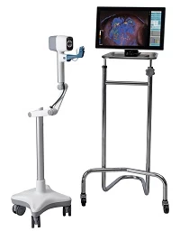 Máy soi cổ tử cung