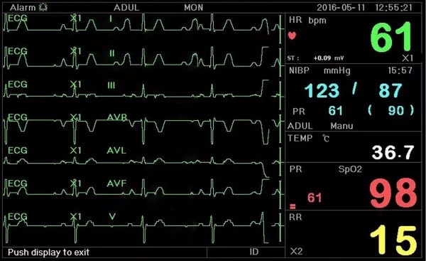 Các thông số trên monitor theo dõi bệnh nhân