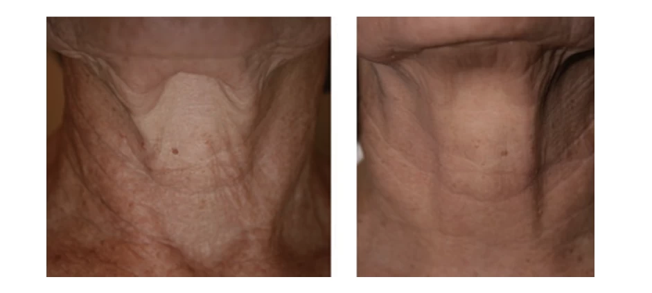 Ứng dụng lâm sàng đa dạng