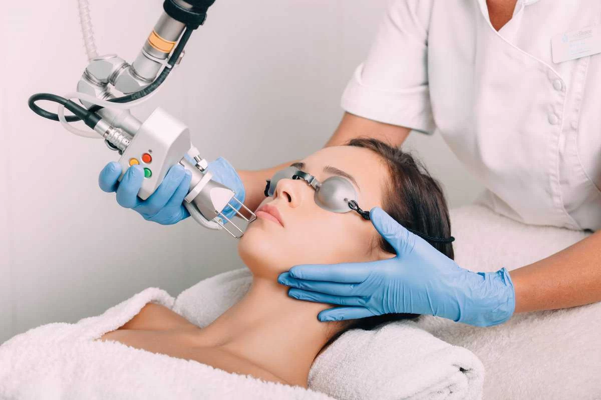 laser CO2 fractional