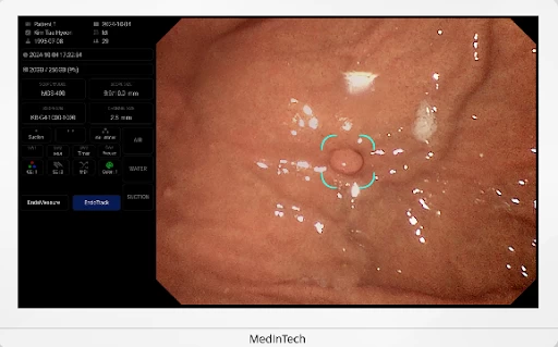 hệ thống nội soi dạ dày đại tràng có motor ME-470 của MedInTech
