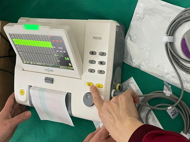 Cách chọn máy monitor sản khoa phù hợp