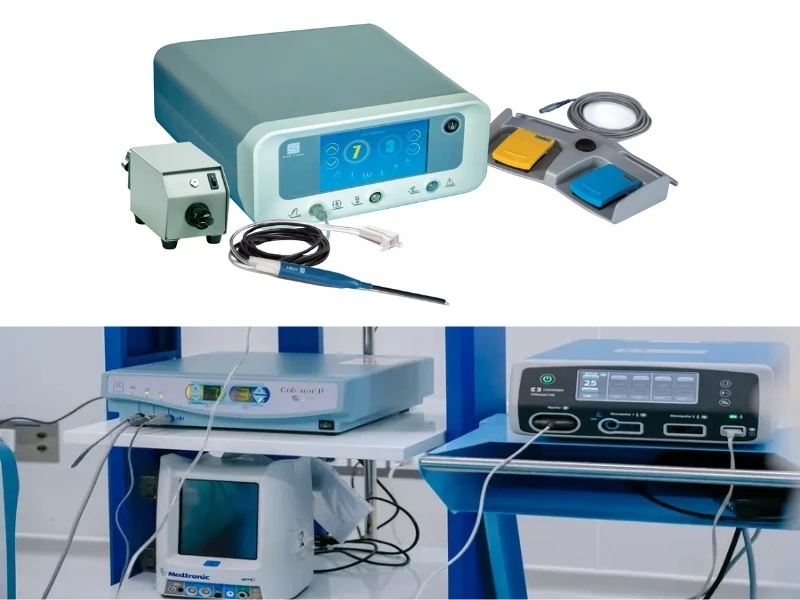Công nghệ Coblation giúp giảm tổn thương nhiệt và hỗ trợ hồi phục nhanh