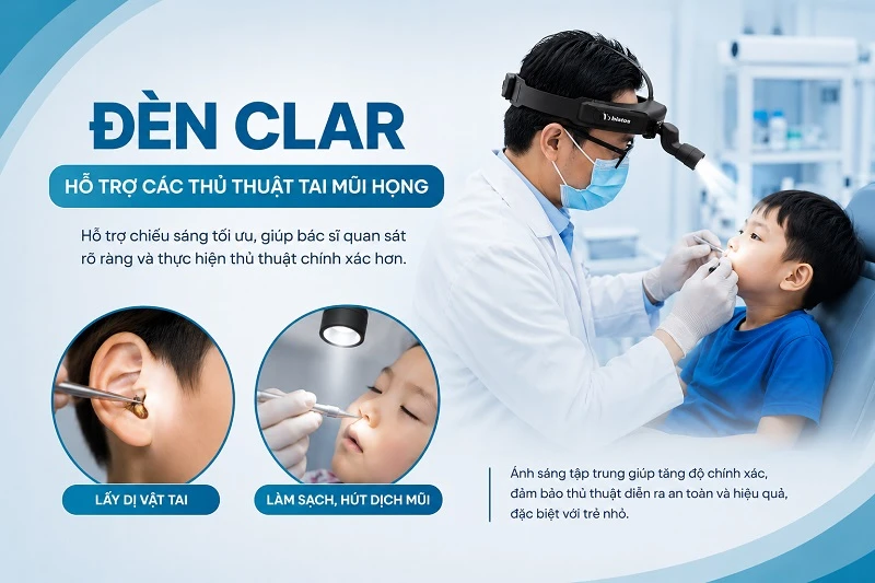 Đèn Clar hỗ trợ bác sĩ thực hiện thủ thuật Tai Mũi Họng