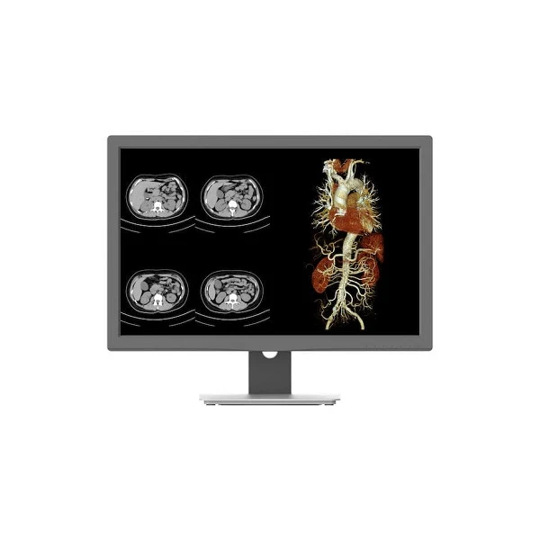 Màn hình y tế cho chẩn đoán lâm sàng 24 inch CR240G