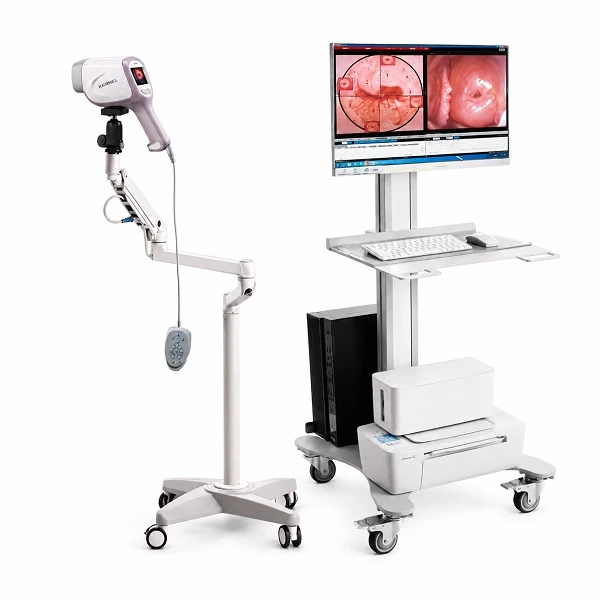 Máy soi cổ tử cung KN-2200A (1)