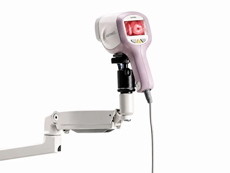 Máy soi cổ tử cung KN-2200A (2)
