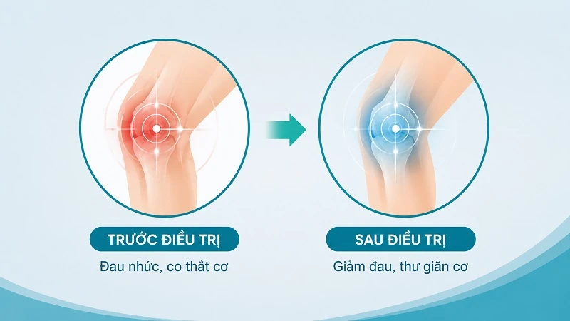 Siêu âm trị liệu giúp giảm đau trong phục hồi chức năng