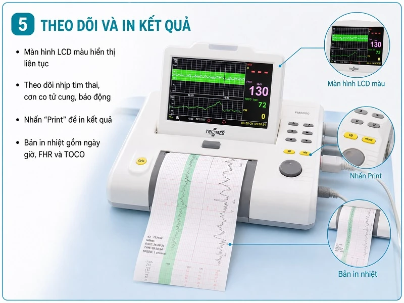 Theo dõi và in kết quả